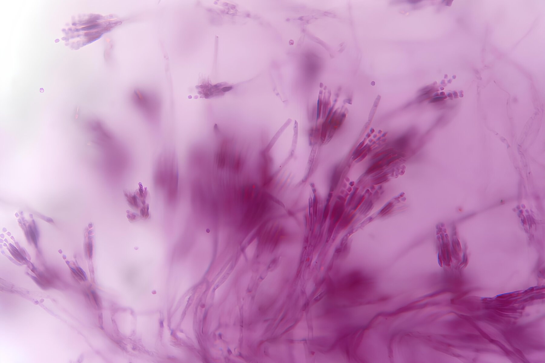 Detaliu macro la microscop al unei ciuperci Penicillium, conidiofori ramificati